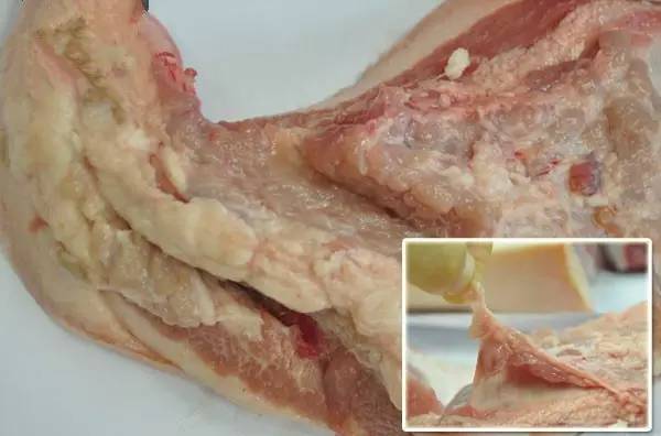 猪肉里瘤子图片图片
