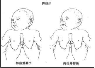 新生儿窒息后血清中神经元特异性烯醇化酶及总胆红素的变化及临床意义