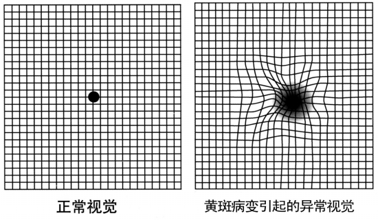 视野检查正常图片