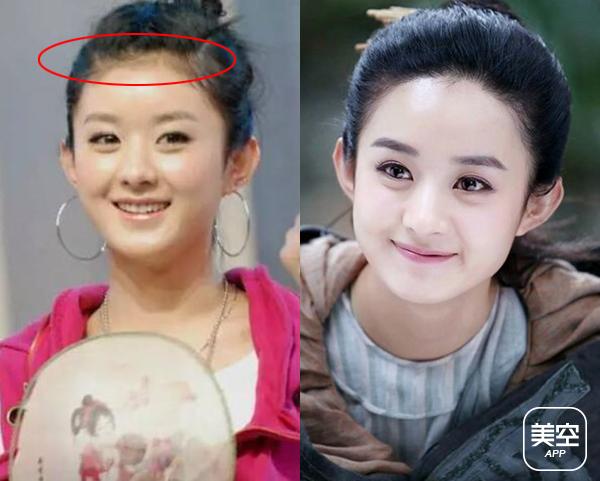 娱乐 正文 露额头才是真美女,但是如果发际线不好看,一切都白搭,下面