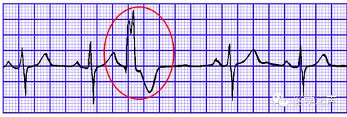心电图课堂