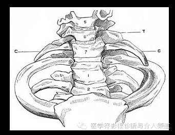 颈肋综合征图片