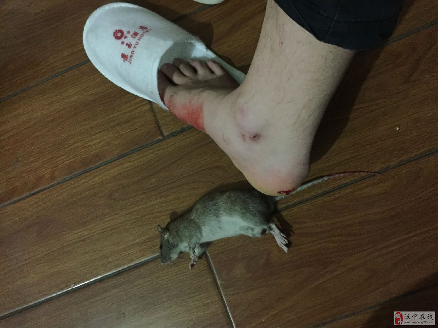 老鼠咬人事件图片
