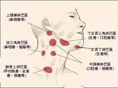 人体下颚两边的淋巴结图片