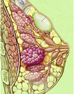 乳房硬块图片 结构图片