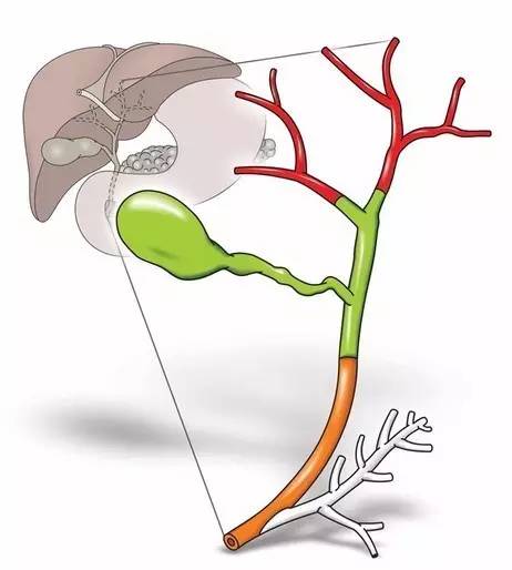 (胆管示意图)