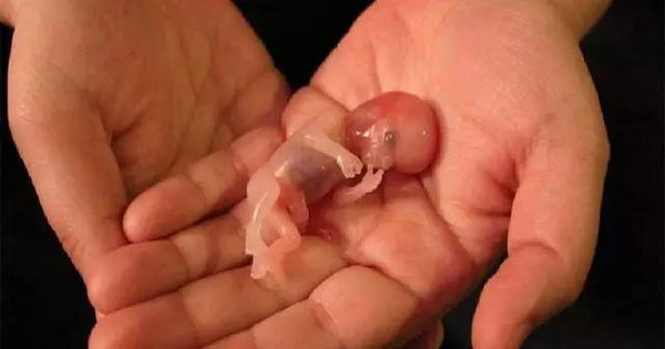 顽强的婴儿堕胎后仍然活着,没想到医生是这样做的!