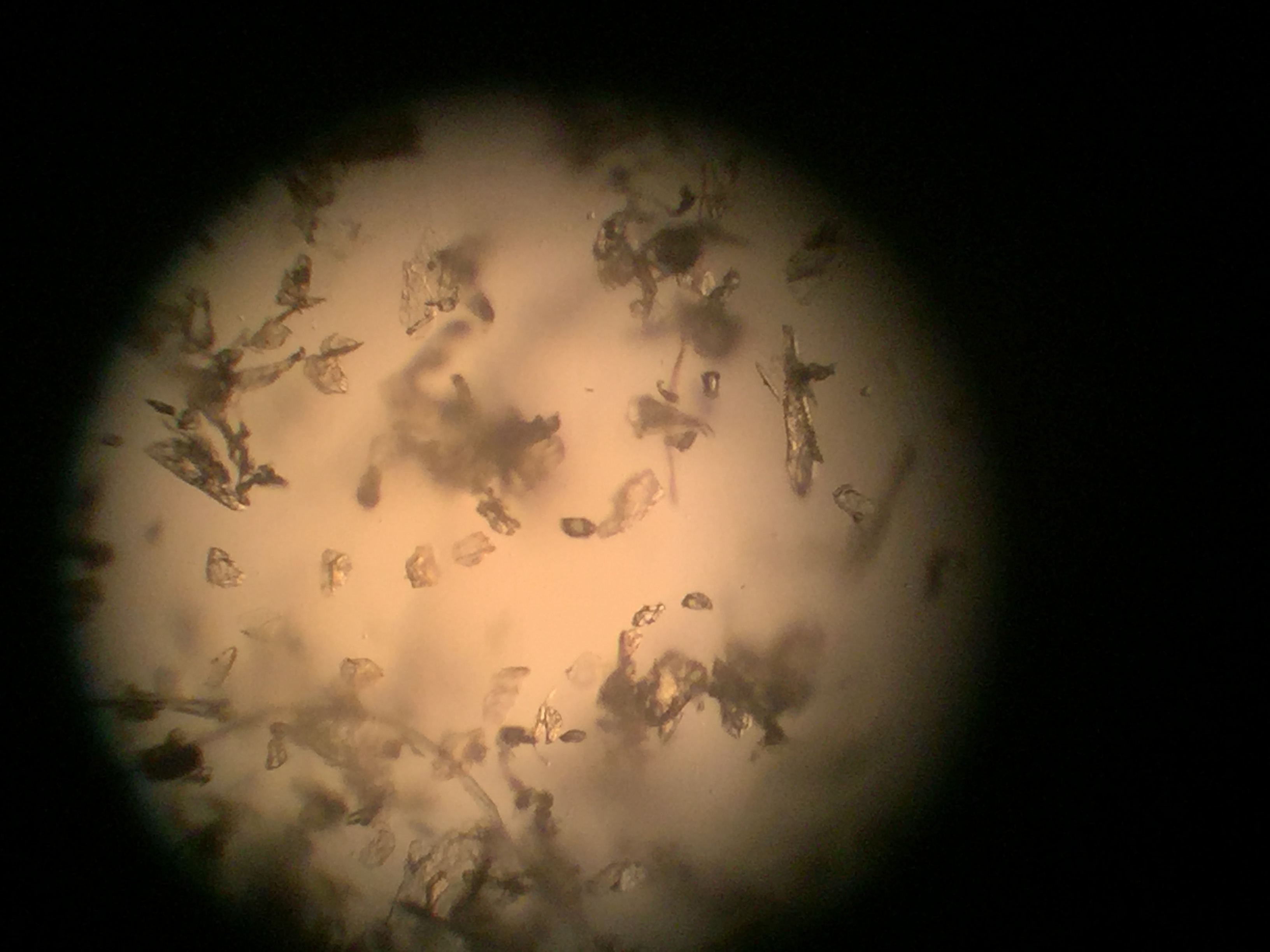螨虫背显微镜图片