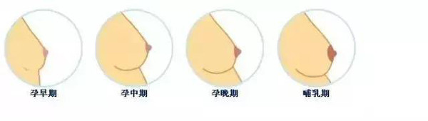 怀孕乳头变化图图片