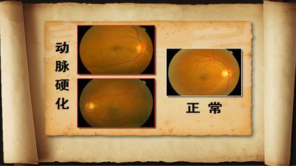 看眼球诊断疾病图片图片
