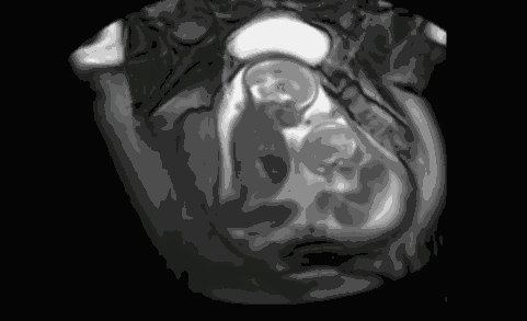 拳打脚踢的胎动动态图图片