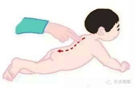 治疗小儿发烧的按摩手法 ——推三关(图) 3,推脊柱 【位置】在后正