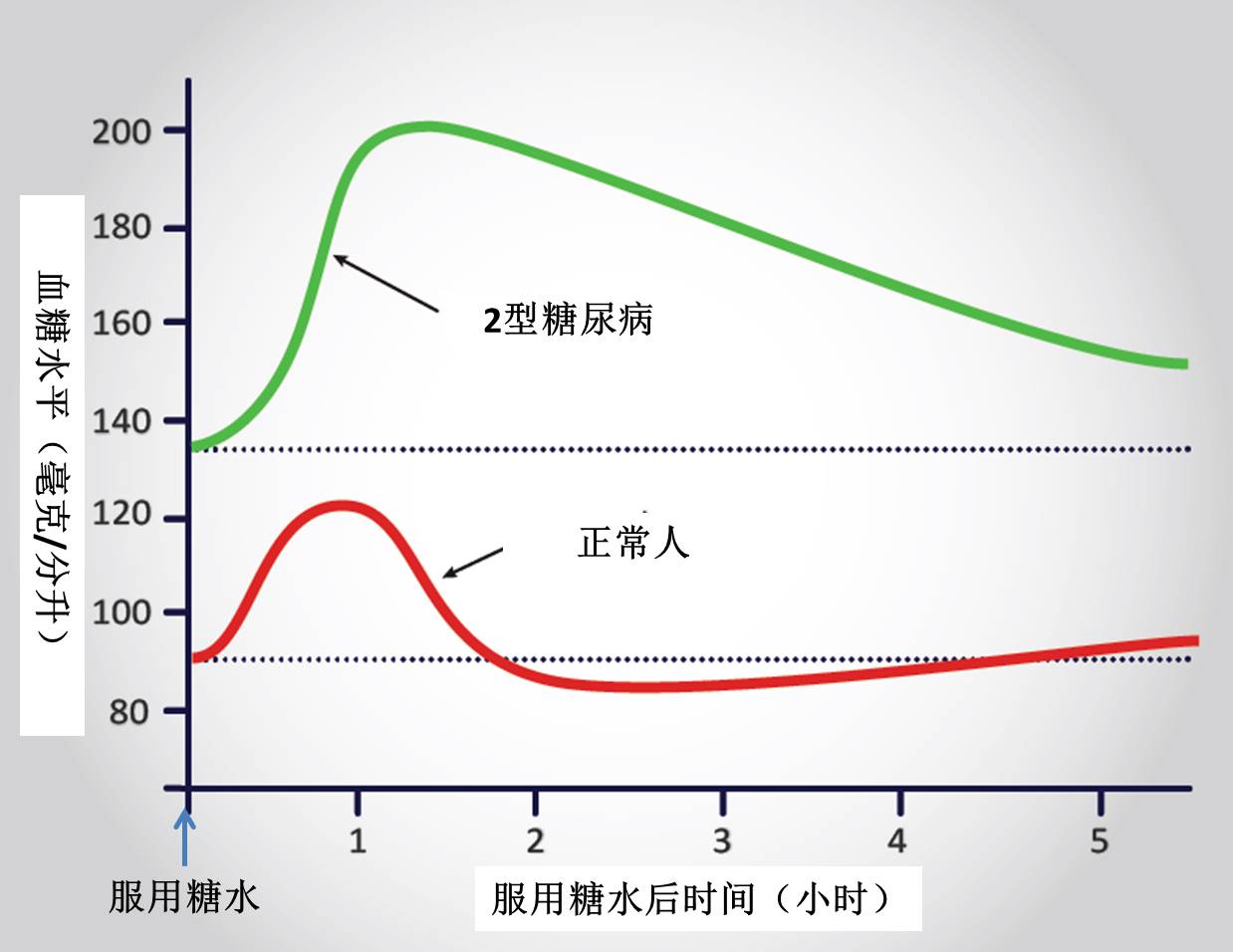 而i型和2型糖尿是身体对糖的利用能力下降(胰岛素减少或胰岛素抵抗)