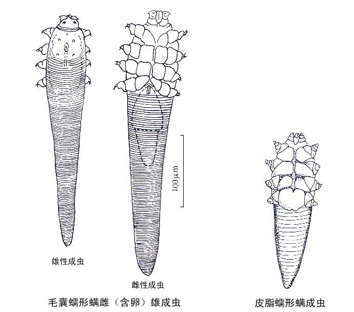 毛囊蠕形螨图片绘图图片