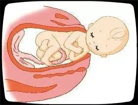 众所周知,产妇生产的过程中,胎儿的头部及身体需要经过产道的挤压而