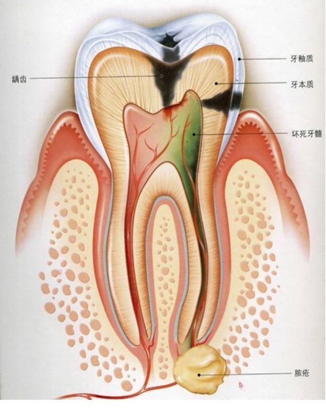 牙骨质包绕着,仅在很尖孔与根尖周组织相联系;牙髓的神经来自三叉神经