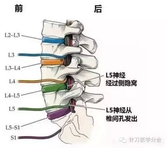 腰椎间盘突出的针刀治疗定位与操作技巧