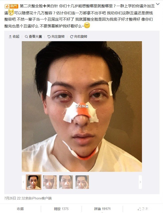 蛇精男被整容医院法律起诉,蛇精病又犯了?