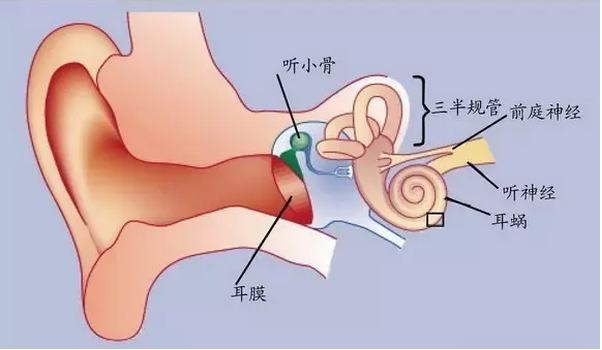 由内耳迷路或前庭部分,前庭神经颅外段(在内听道内)病变引起的眩晕为