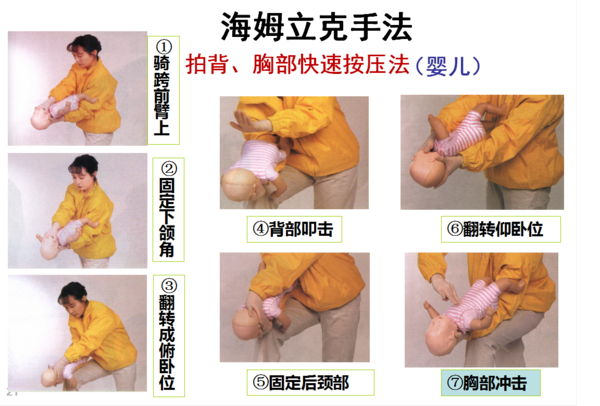 海氏手法又叫做"腹部冲击法.