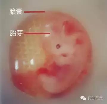 怀孕30天胎儿发育图片图片