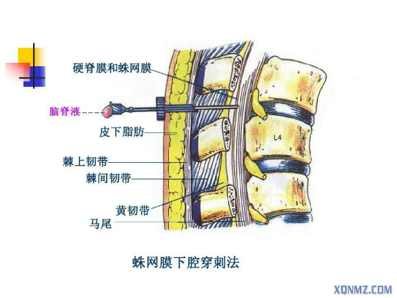 腰椎管矢状径图片
