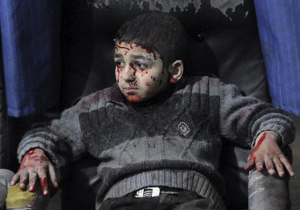 叙利亚战争照片小孩子图片