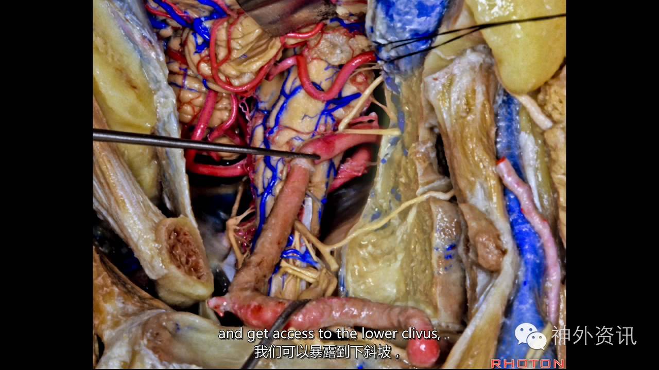 医科大学解剖录像图片