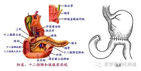 treitz韧带解剖图片图片