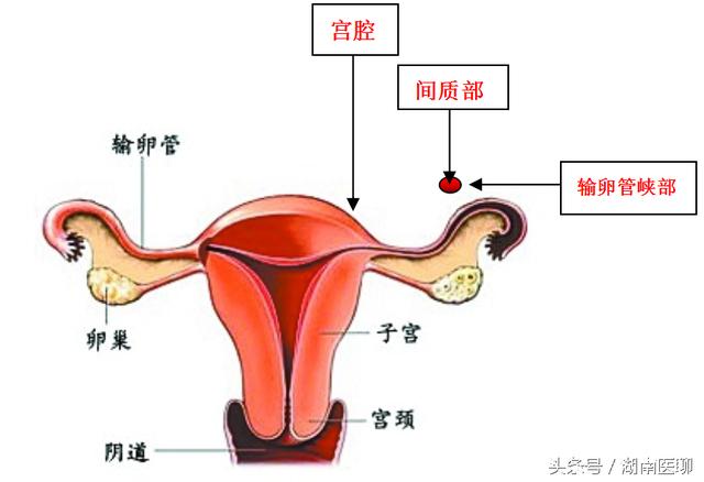 输卵管的位置图图片