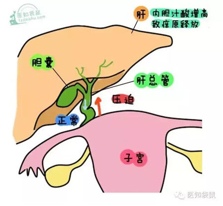 越来越大的子宫会压迫内脏