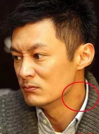 王俊凯脖子上的草莓印图片