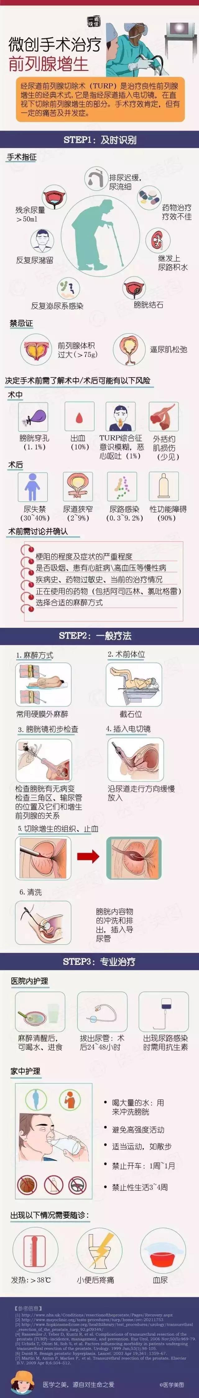 前庭大腺炎手术过程图片