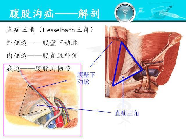 腹股沟区解剖结构3d图图片
