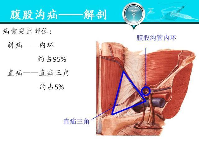 腹股沟区解剖图详细图片
