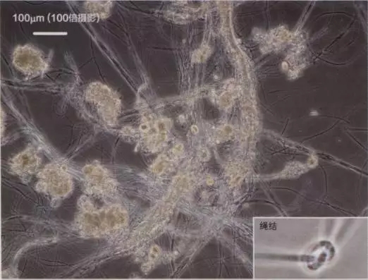 丝状菌膨胀图片图片