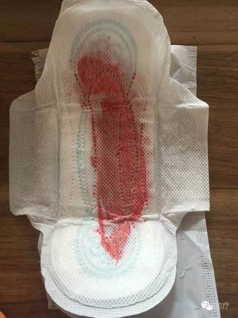 5毫升血几张卫生巾图片