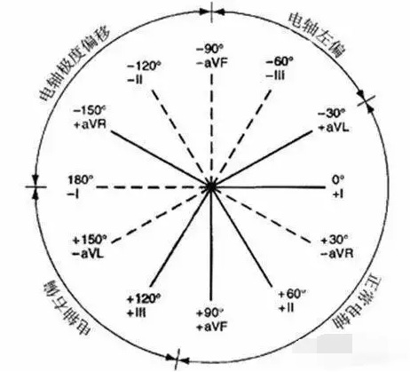 心电轴范围图片