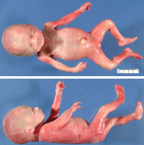 60天的胎儿图片欣赏图片