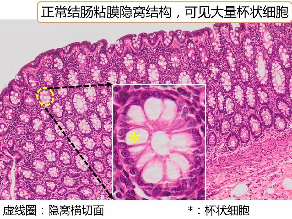 结肠杯状细胞图片