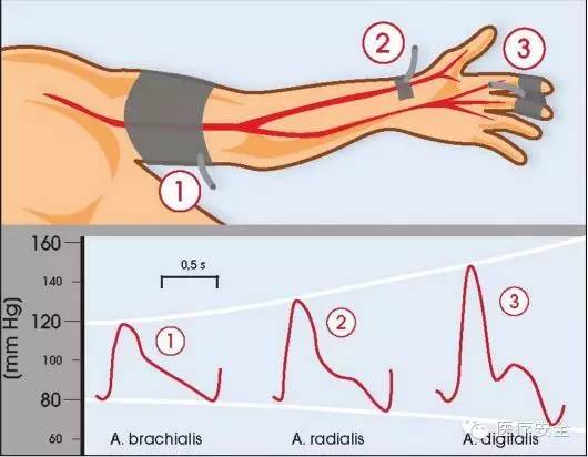 血压计肱动脉位置图片