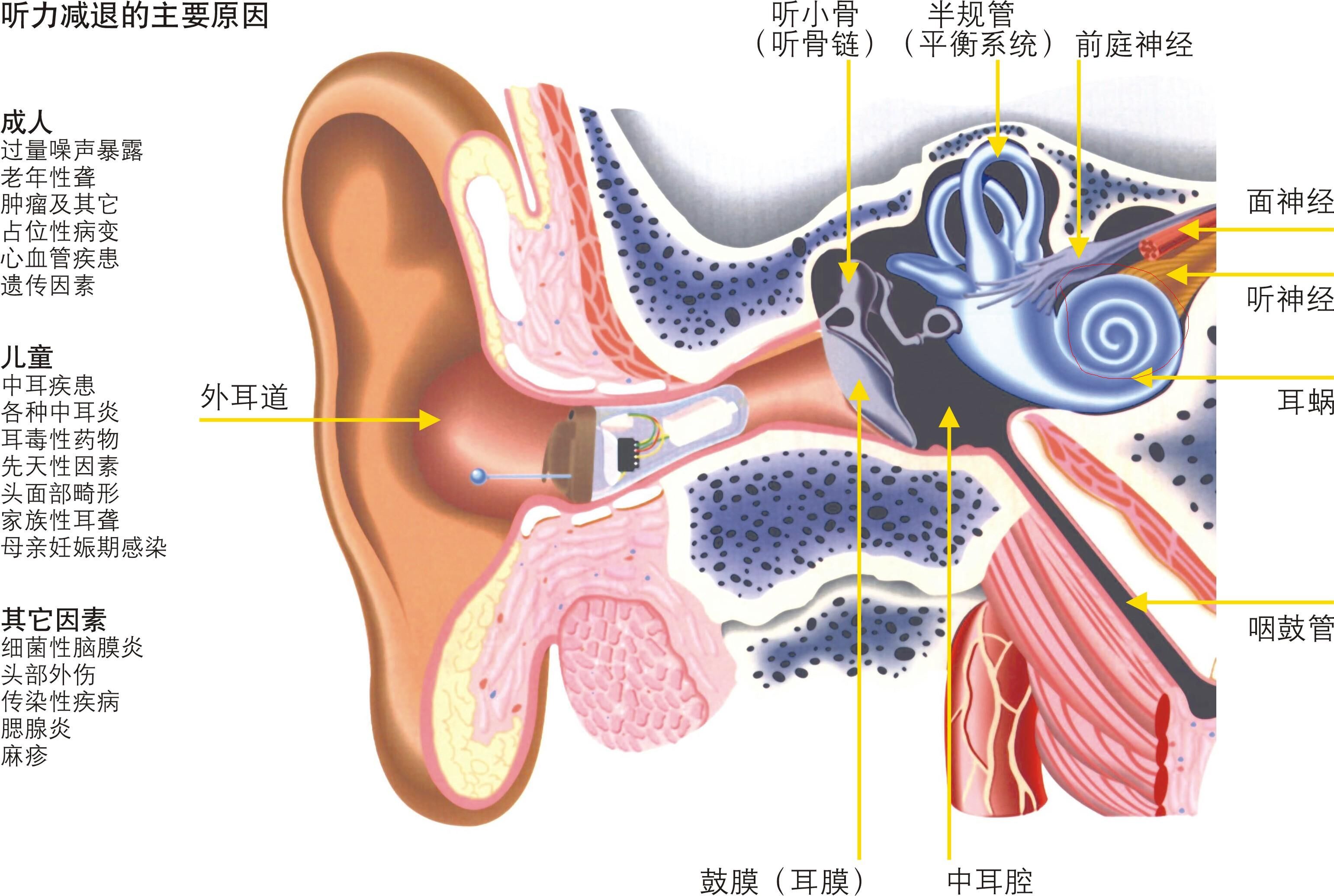 助听器内部结构图图片