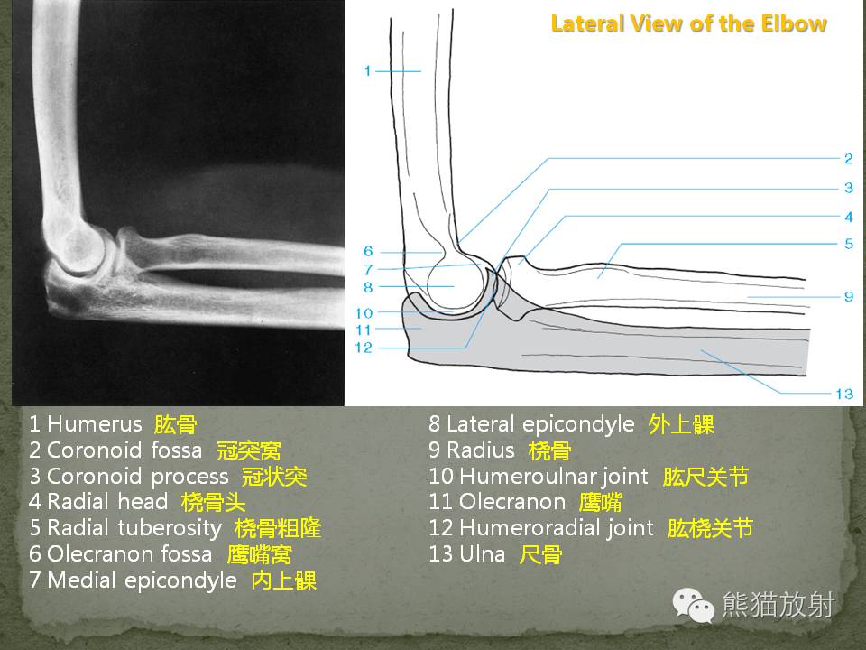 肘关节x线解剖图片