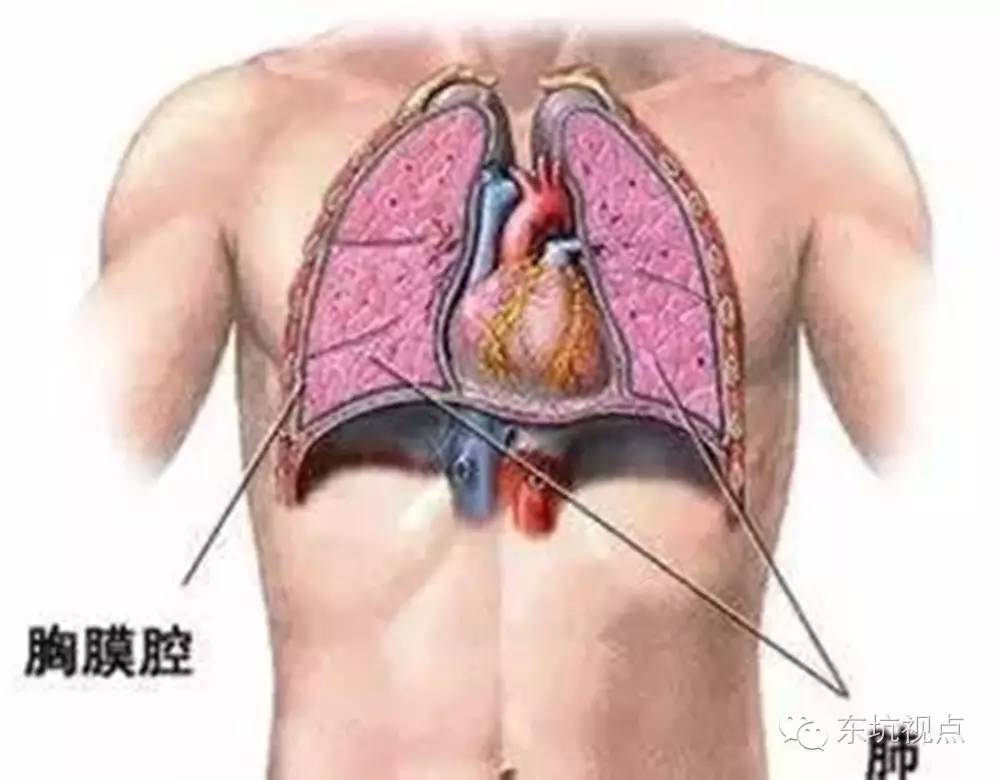 气胸症状(张力性气胸症状)-第1张图片-鲸幼网