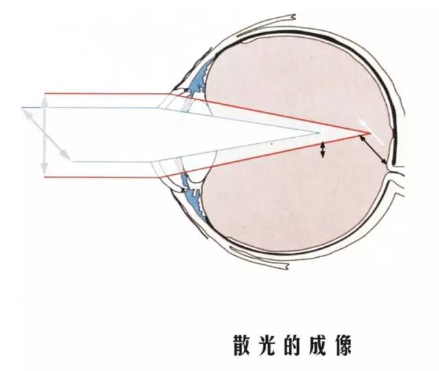 科普:秒懂什麼是近視,遠視,散光,老花眼 你一定不知道如何正確地配鏡