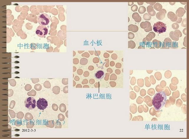 淋巴细胞正常值图片