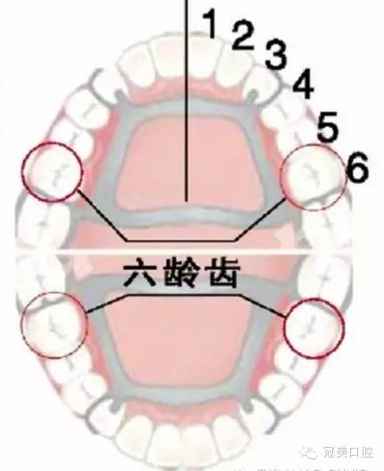 之所以会这样,是因为绝大部分家长把这颗牙当做了乳牙,认为反正是要换