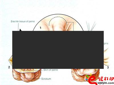 变性手术后图片器官图片