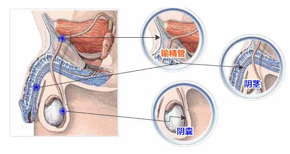 输精管有几条图片