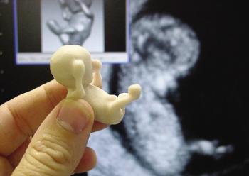 孕十二周男女胎儿图图片